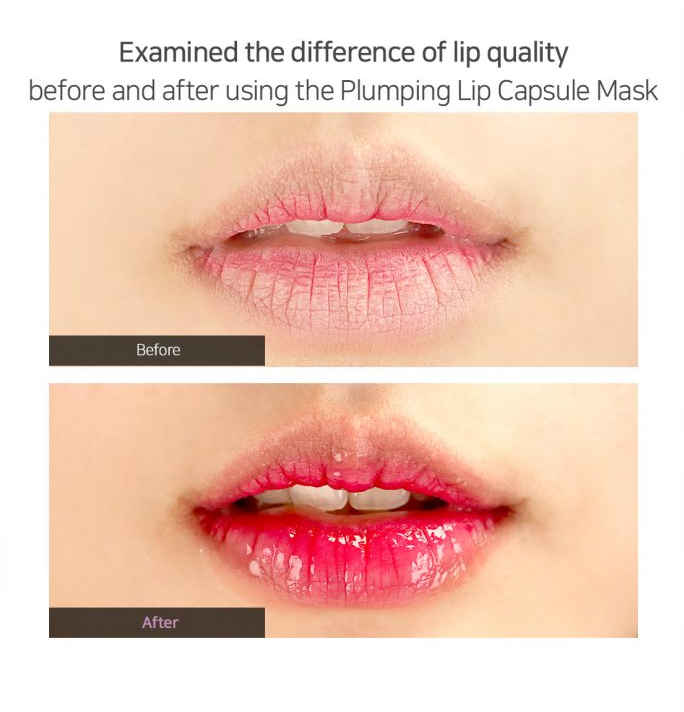 lip-plump_061.png lip-plump_061.png